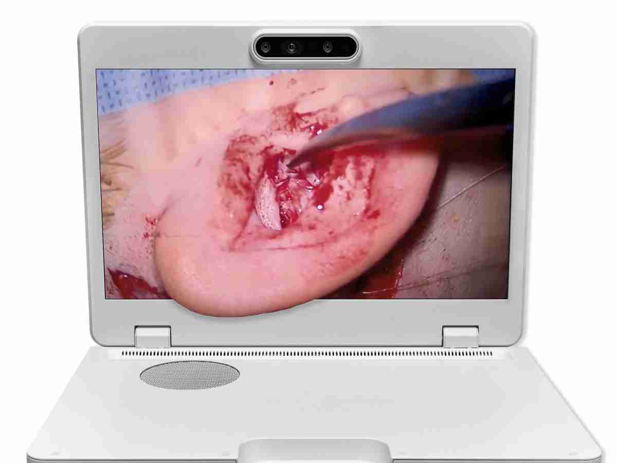 达擎之＂Heads-up 3D显微手术显示系统＂，，，整合4K裸眼3D显示及眼球追踪系统，，具备快速追踪人眼移动位置功能，，，，减轻医师长时间维持固定姿势的负担，，，让医师能有更宽广清晰的3D立体视野及更舒适的姿势来执行手术。。